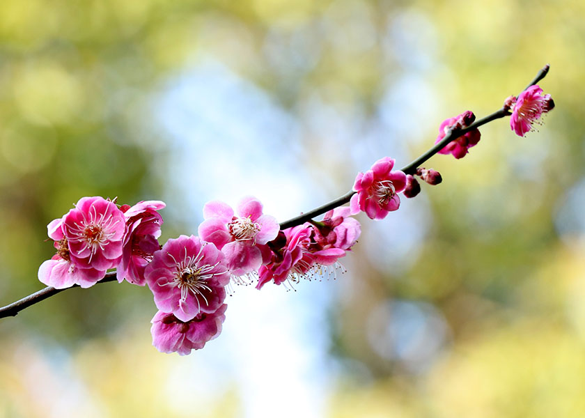 Image for article [Celebrating World Falun Dafa Day] By Reciting “Falun Dafa Is Good,” Third-Degree Burn Patient Heals Without Graft Surgery